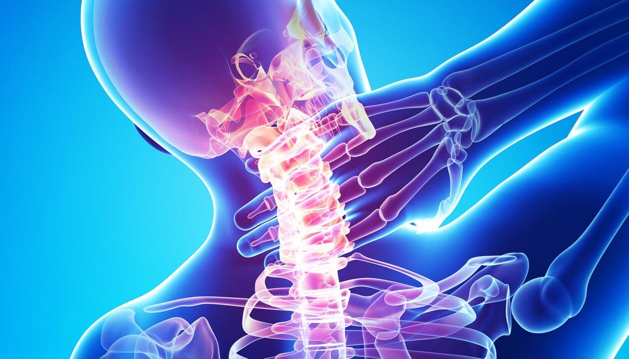 πόνος στον αυχένα λόγω οστεοχονδρωσίας